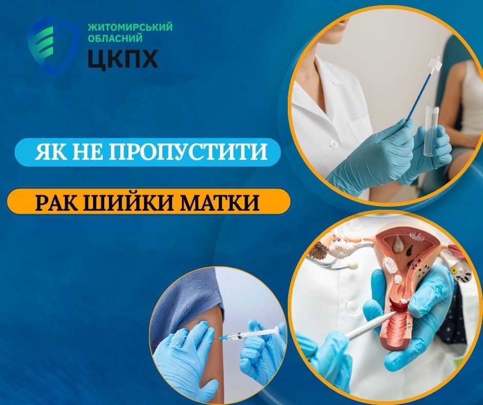 Рак шийки матки